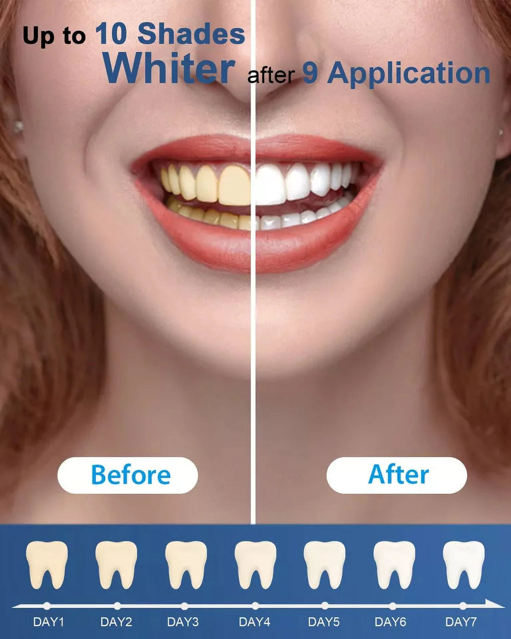 10Pc X 3Ml Peroxide Teeth Whitening Gel Refill Tooth Whitener Non Sensitive, Economy Packaging