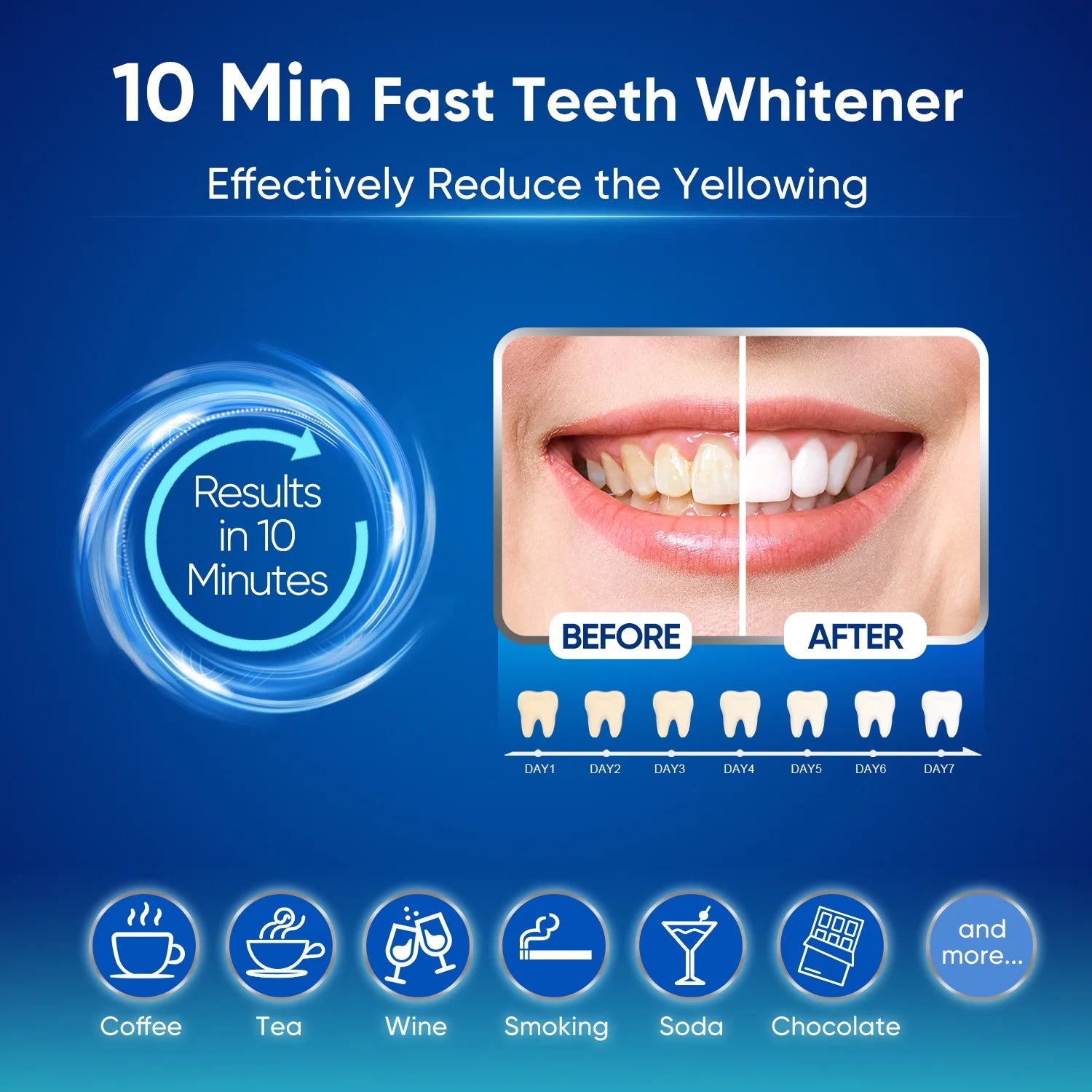 10Pc X 3Ml Peroxide Teeth Whitening Gel Refill Tooth Whitener Non Sensitive, Economy Packaging