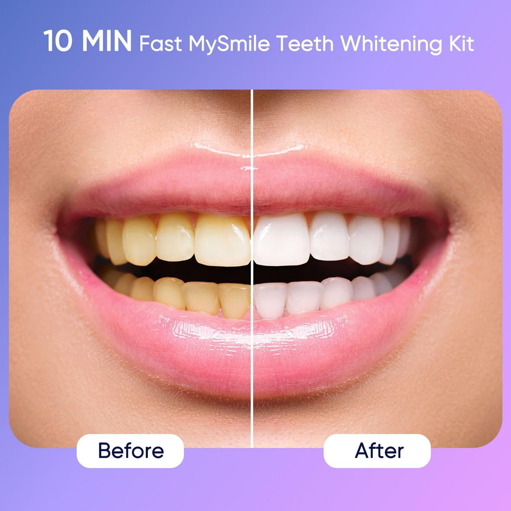 Deluxe 10 Min Teeth Whitening Kit with 28 LED Light, 35% Carbamide Peroxide Teeth Whitening Gel, Helps Remove Years of Stains from Coffee, Soda, Wines, Smoking, Food
