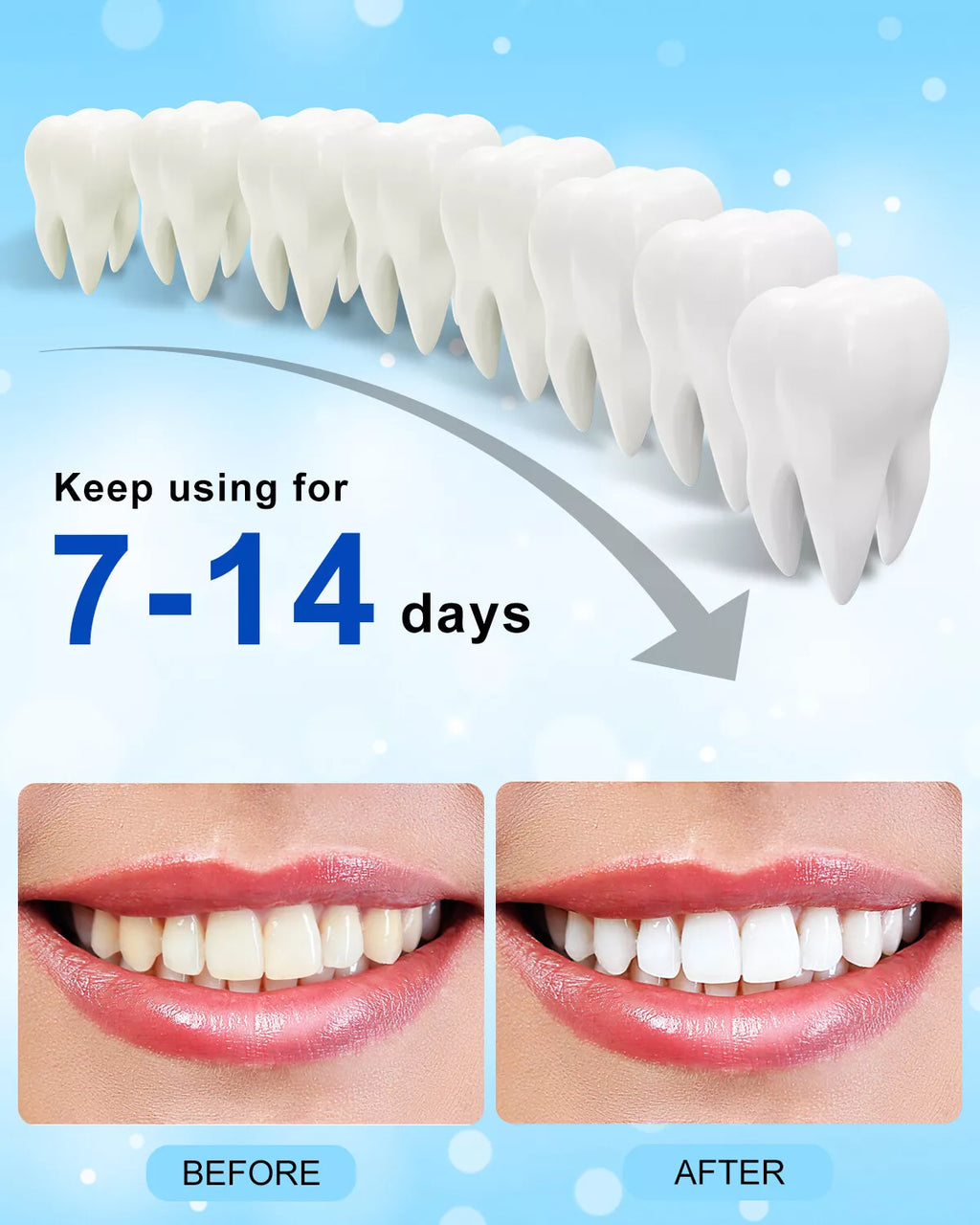10Pc X 3Ml Peroxide Teeth Whitening Gel Refill Tooth Whitener Non Sensitive, Economy Packaging